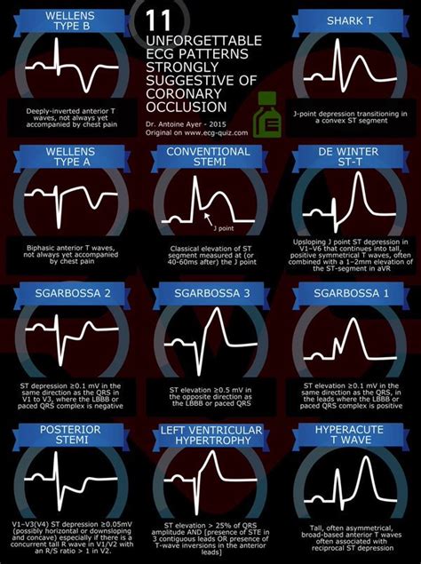 heartbeat search results